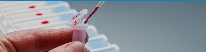 Tipus de test de coronavirus i indicacions