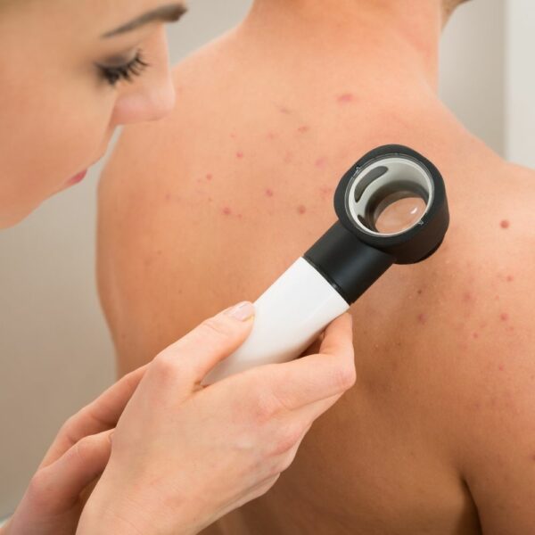 consulta-derma-barcelona